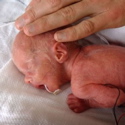 Georgia scores an “F” for Premature Birth Rate
